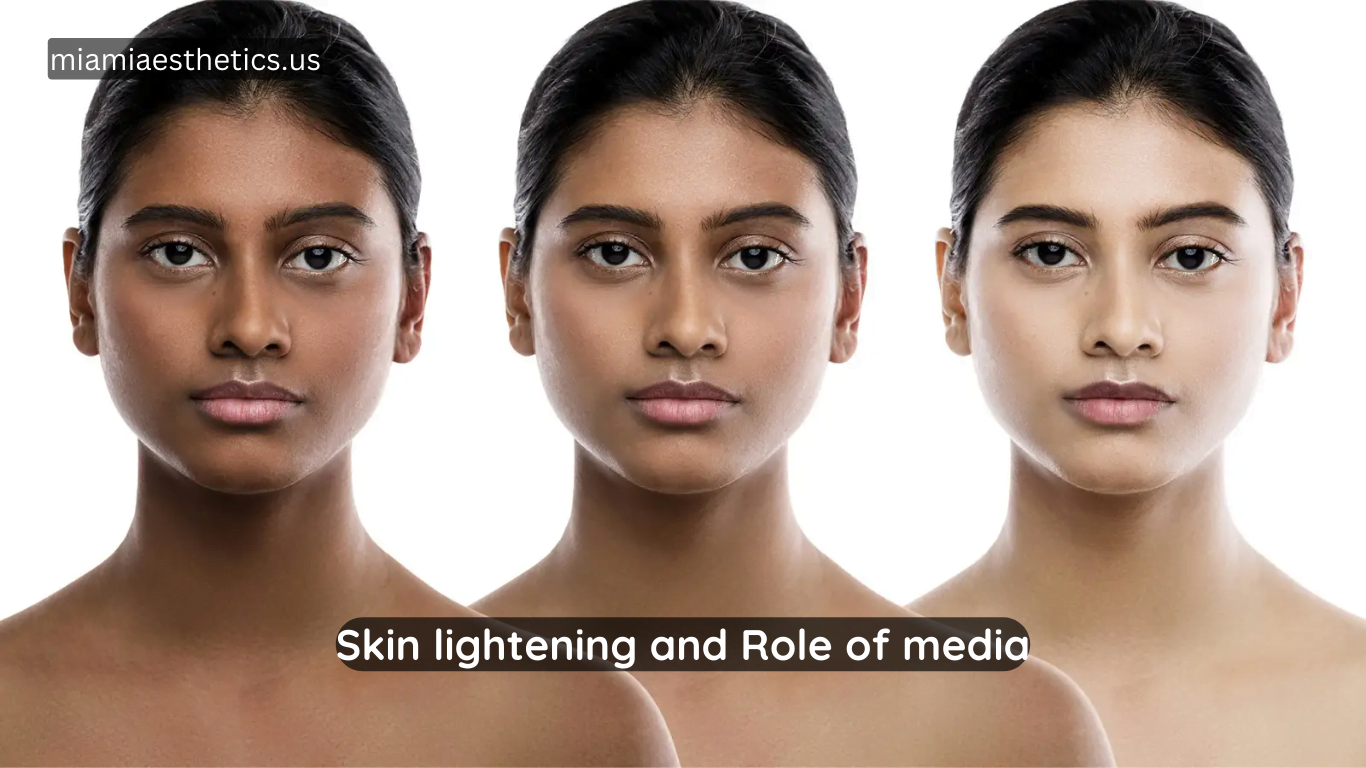 Skin lightening and Role of media Miami Aesthetics